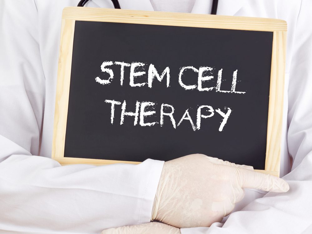 What-is-stemcell-therapy