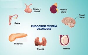 endocrine-disorder