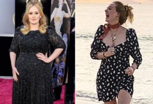 Adele-weight-loss-surgery