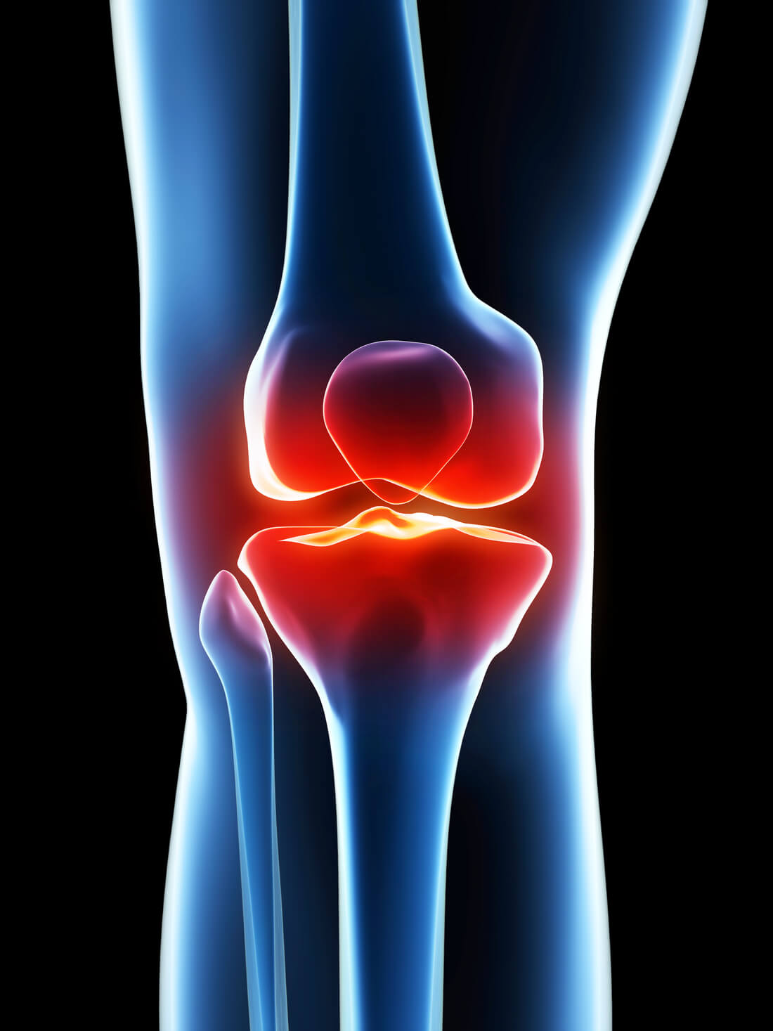Bone & Joint Stem Cell Therapy