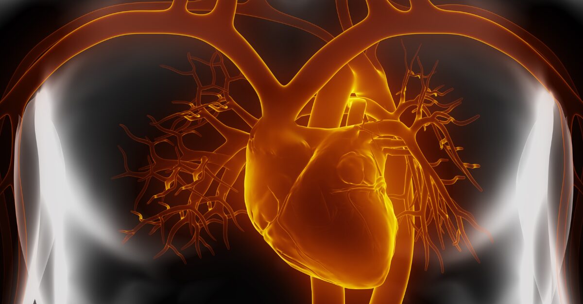 Heart Sten Cell Treatment
