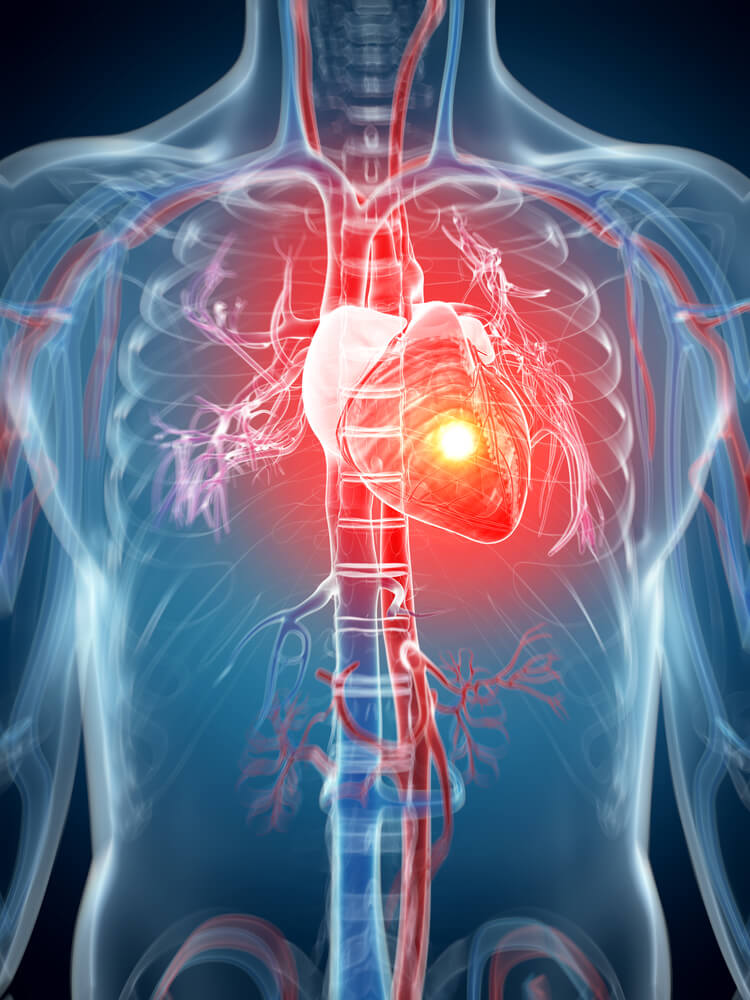 Heart Stencell Treatment
