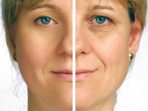 Skin stem cell treatment